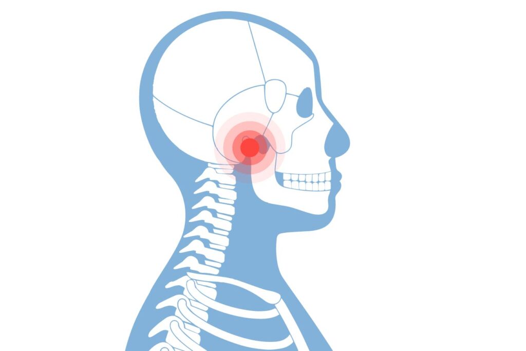 dolor mandibula